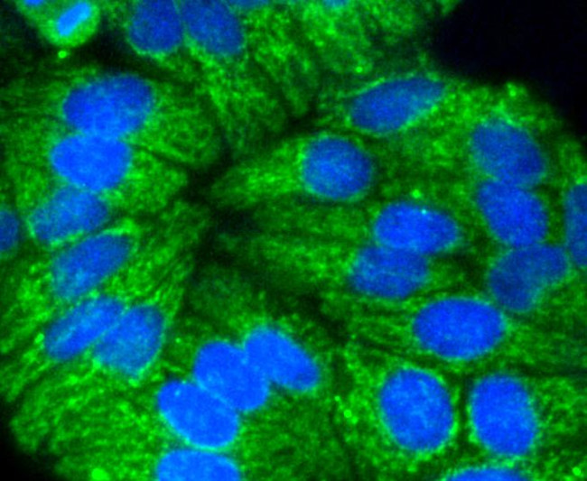 Cytokeratin 17 Antibody in Immunocytochemistry (ICC/IF)