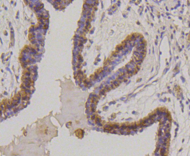 Cytokeratin 17 Antibody in Immunohistochemistry (Paraffin) (IHC (P))