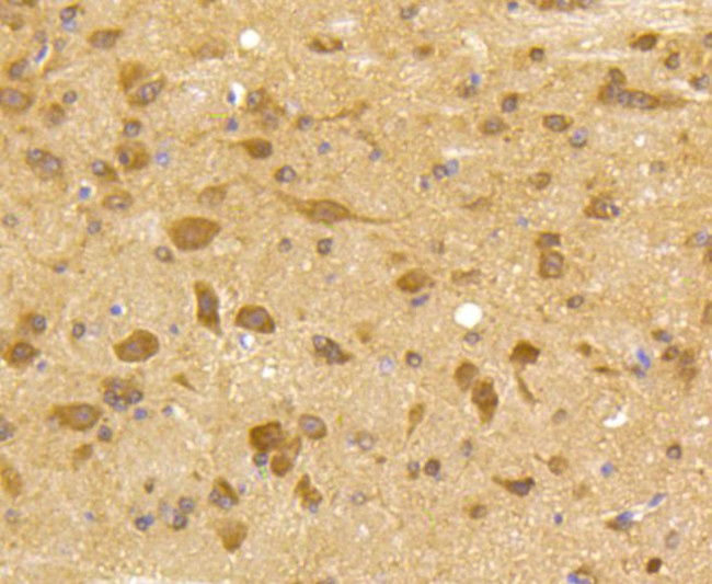 CDK5 Antibody in Immunohistochemistry (Paraffin) (IHC (P))