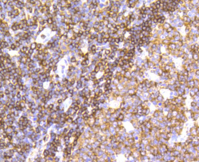 SHP-1 Antibody in Immunohistochemistry (Paraffin) (IHC (P))