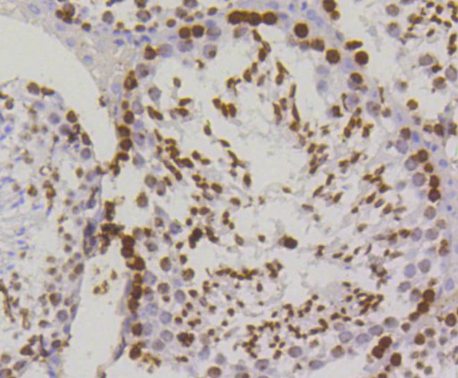 Phospho-Histone H2A.X (Ser139) Antibody in Immunohistochemistry (Paraffin) (IHC (P))