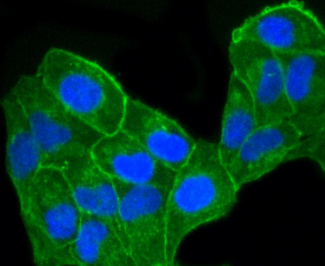 CCR7 Antibody in Immunocytochemistry (ICC/IF)