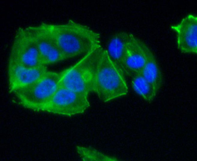 CCR7 Antibody in Immunocytochemistry (ICC/IF)