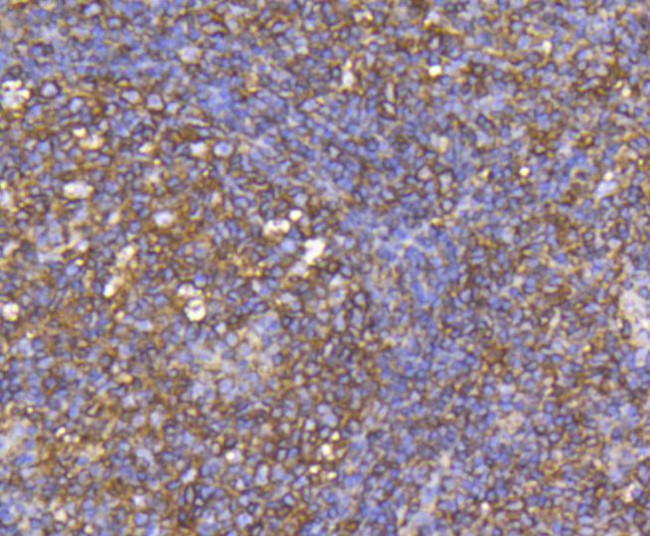 CCR7 Antibody in Immunohistochemistry (Paraffin) (IHC (P))