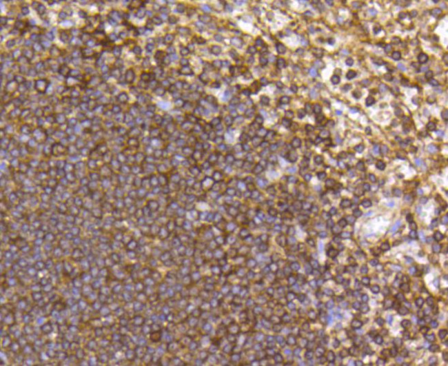 CCR7 Antibody in Immunohistochemistry (Paraffin) (IHC (P))