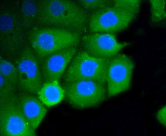 RhoA/RhoB/RhoC Antibody in Immunocytochemistry (ICC/IF)