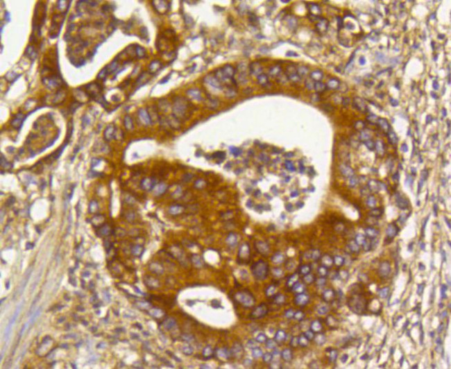 RhoA/RhoB/RhoC Antibody in Immunohistochemistry (Paraffin) (IHC (P))