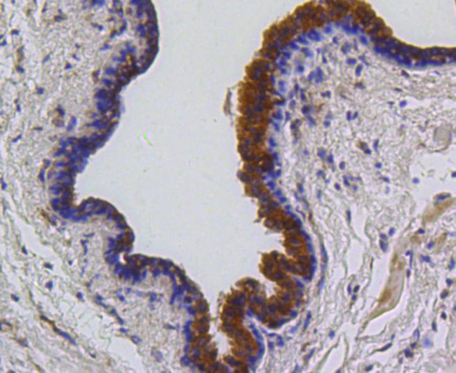 PUMA alpha Antibody in Immunohistochemistry (Paraffin) (IHC (P))