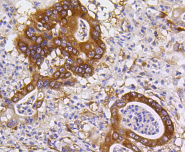 PUMA alpha Antibody in Immunohistochemistry (Paraffin) (IHC (P))