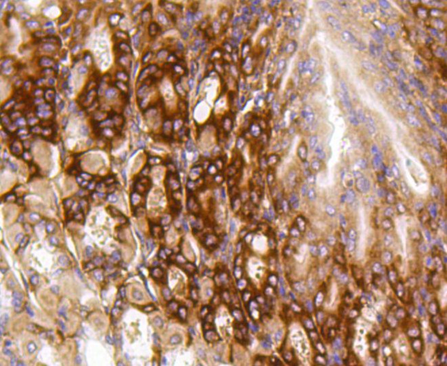 PUMA alpha Antibody in Immunohistochemistry (Paraffin) (IHC (P))