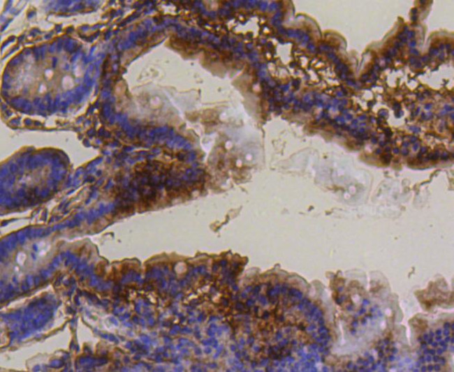 PUMA alpha Antibody in Immunohistochemistry (Paraffin) (IHC (P))