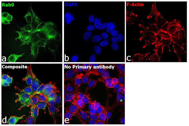 RAB9 Antibody in Immunocytochemistry (ICC/IF)