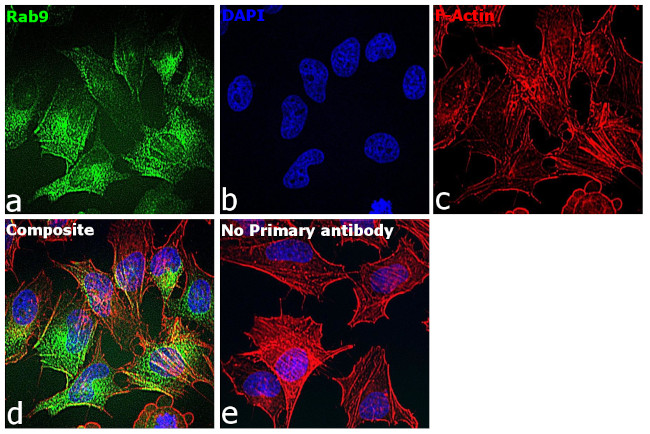 RAB9 Antibody in Immunocytochemistry (ICC/IF)