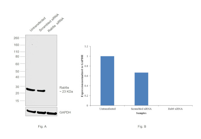 RAB9 Antibody