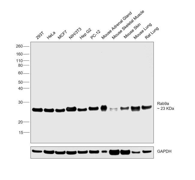 RAB9 Antibody in Western Blot (WB)