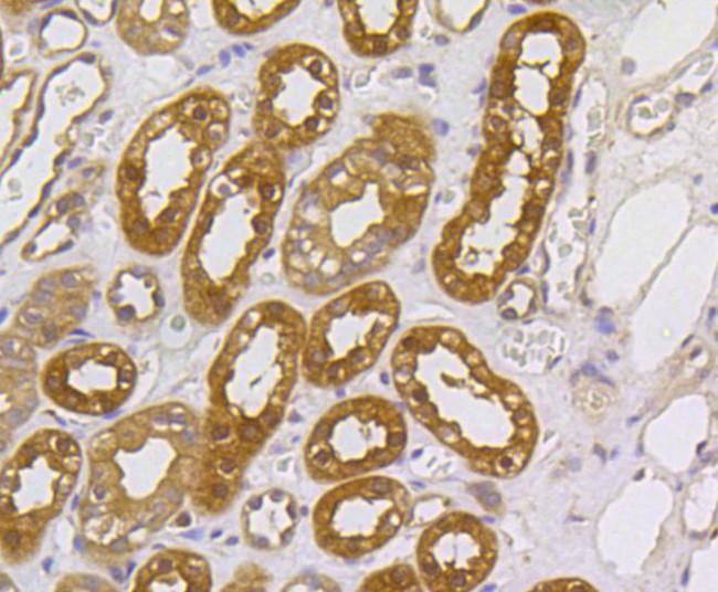 MEK1/MEK2 Antibody in Immunohistochemistry (Paraffin) (IHC (P))