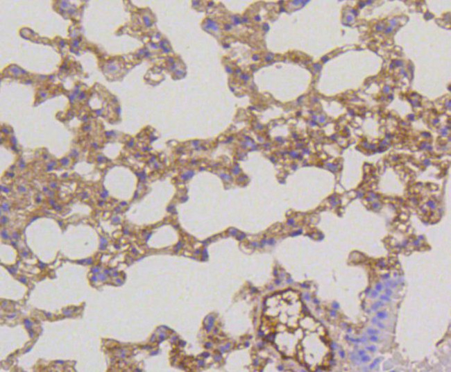 MEK1/MEK2 Antibody in Immunohistochemistry (Paraffin) (IHC (P))