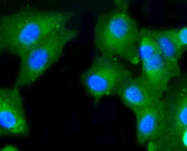 Caspase 2 Antibody in Immunocytochemistry (ICC/IF)