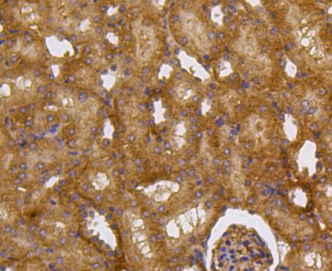 Caspase 2 Antibody in Immunohistochemistry (Paraffin) (IHC (P))