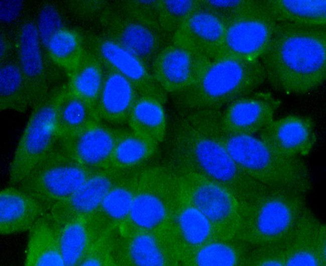 Prohibitin Antibody in Immunocytochemistry (ICC/IF)