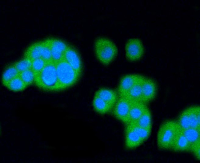 SR-BI Antibody in Immunocytochemistry (ICC/IF)