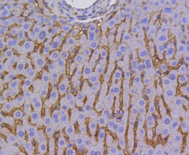 SR-BI Antibody in Immunohistochemistry (Paraffin) (IHC (P))