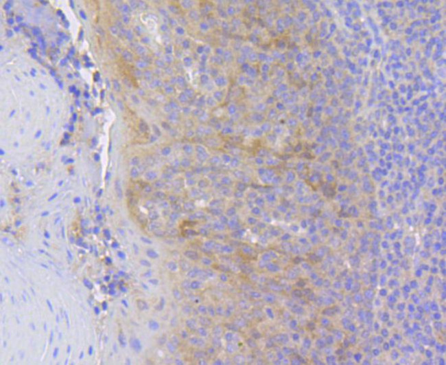 HSC70 Antibody in Immunohistochemistry (Paraffin) (IHC (P))