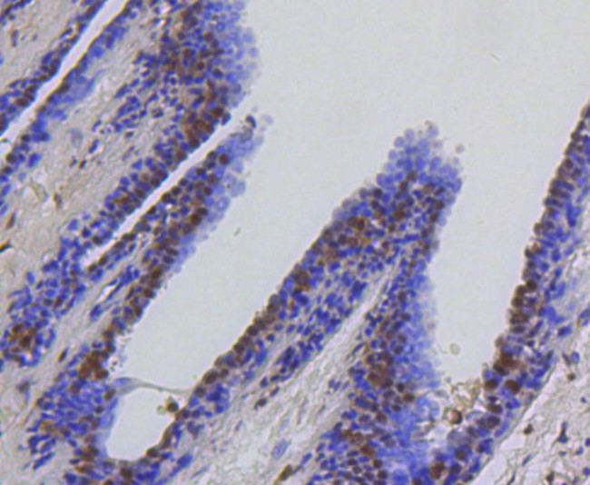 HSC70 Antibody in Immunohistochemistry (Paraffin) (IHC (P))