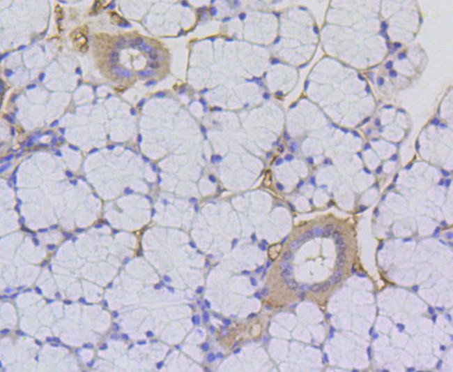 H2AK9ac Antibody in Immunohistochemistry (Paraffin) (IHC (P))