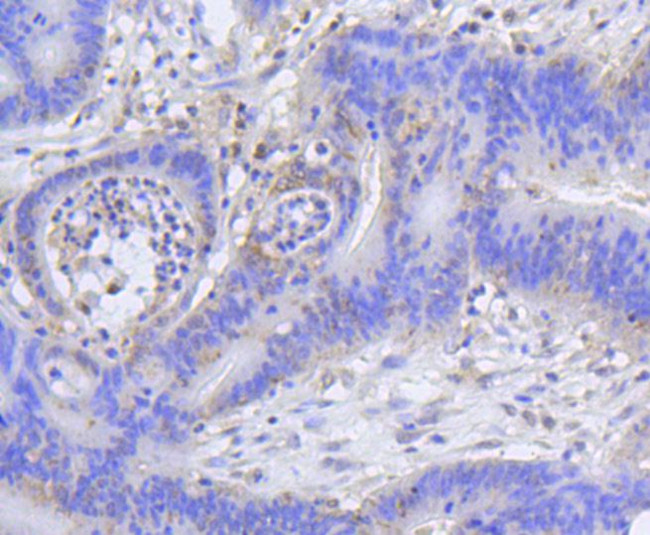 H2AK9ac Antibody in Immunohistochemistry (Paraffin) (IHC (P))