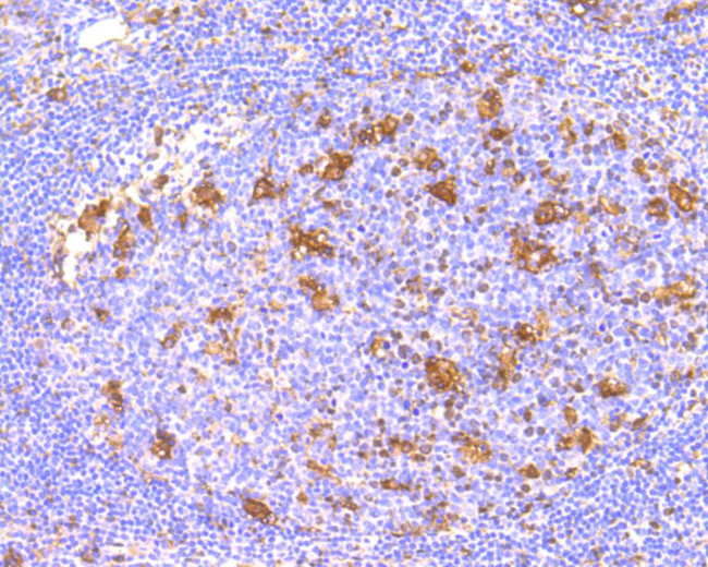 IFNAR1 Antibody in Immunohistochemistry (Paraffin) (IHC (P))