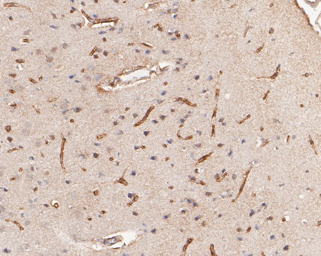 IFNAR1 Antibody in Immunohistochemistry (Paraffin) (IHC (P))