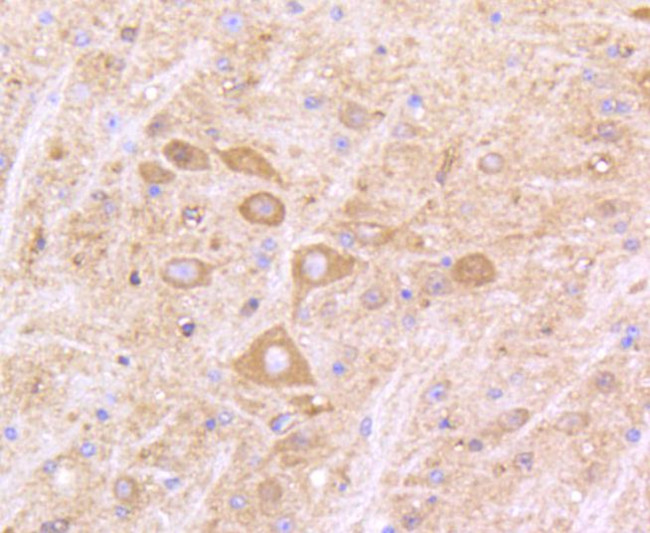 IFNAR1 Antibody in Immunohistochemistry (Paraffin) (IHC (P))