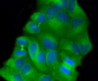 beta-5 Tubulin Antibody in Immunocytochemistry (ICC/IF)