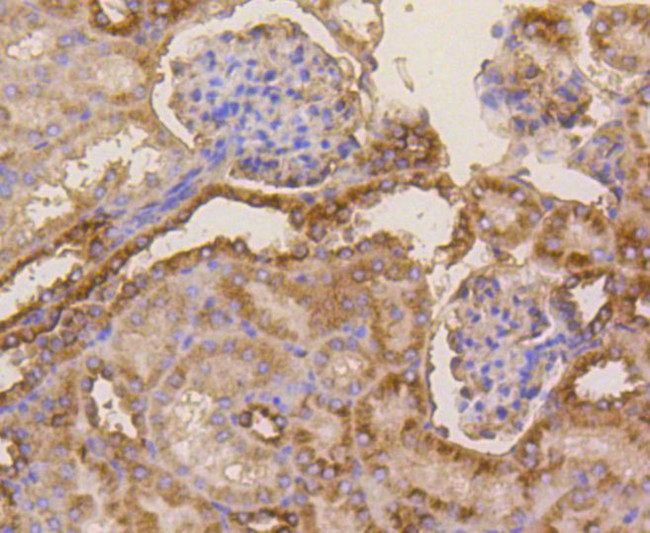 beta-5 Tubulin Antibody in Immunohistochemistry (Paraffin) (IHC (P))