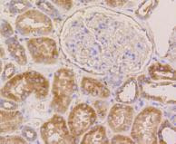 beta-5 Tubulin Antibody in Immunohistochemistry (Paraffin) (IHC (P))