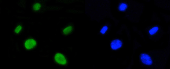 H4K5ac Antibody in Immunocytochemistry (ICC/IF)