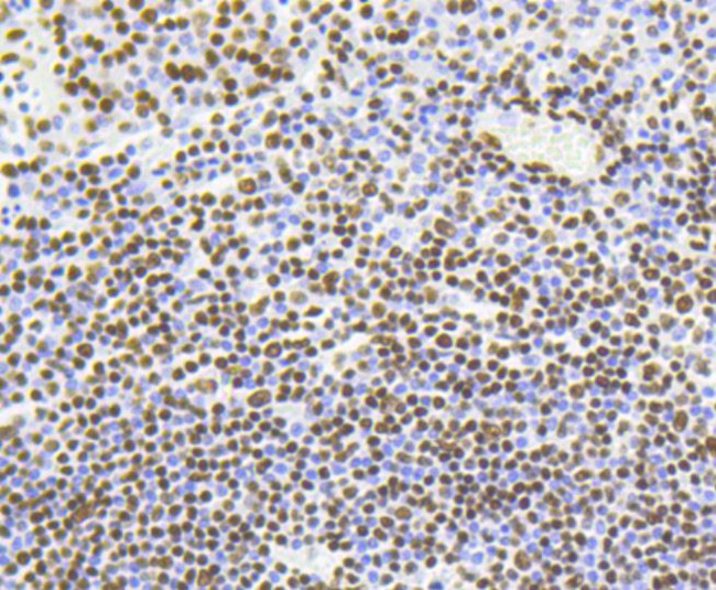 H4K5ac Antibody in Immunohistochemistry (Paraffin) (IHC (P))