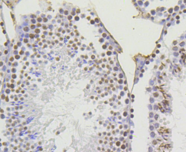 H4K5ac Antibody in Immunohistochemistry (Paraffin) (IHC (P))