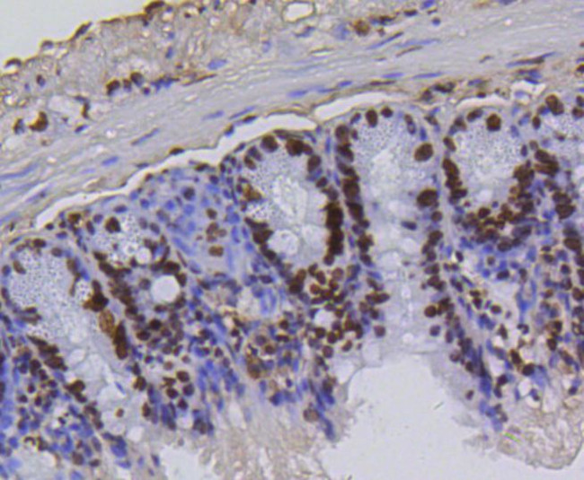 H4K5ac Antibody in Immunohistochemistry (Paraffin) (IHC (P))