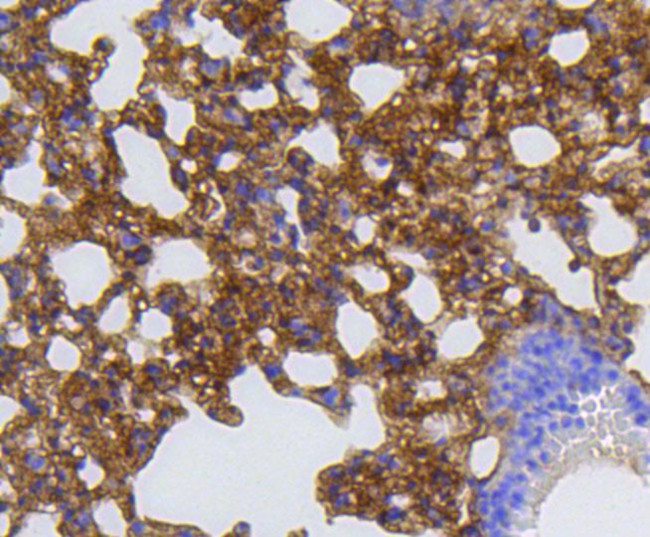 MMP12 Antibody in Immunohistochemistry (Paraffin) (IHC (P))