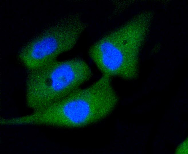 Active Caspase 3 Antibody in Immunocytochemistry (ICC/IF)