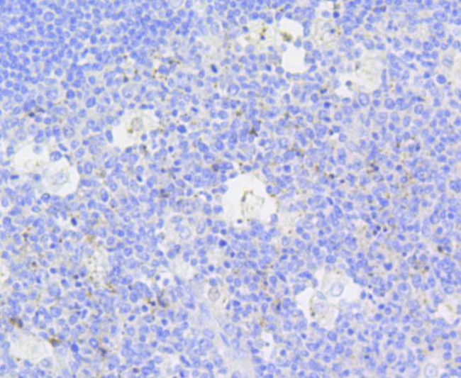 Active Caspase 3 Antibody in Immunohistochemistry (Paraffin) (IHC (P))