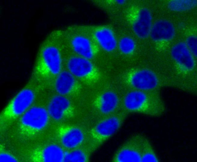 IGF2R Antibody in Immunocytochemistry (ICC/IF)