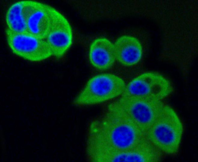 IGF2R Antibody in Immunocytochemistry (ICC/IF)