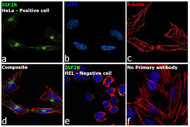 IGF2R Antibody in Immunocytochemistry (ICC/IF)