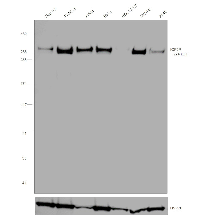 IGF2R Antibody