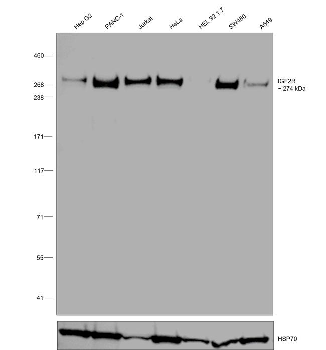 IGF2R Antibody in Western Blot (WB)