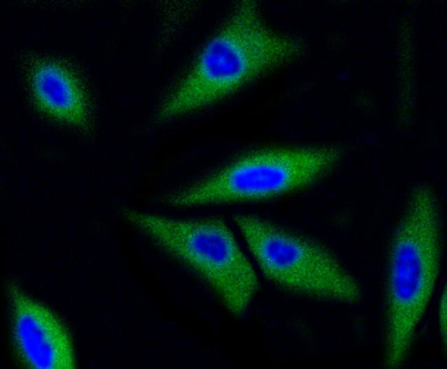 CDK2 Antibody in Immunocytochemistry (ICC/IF)