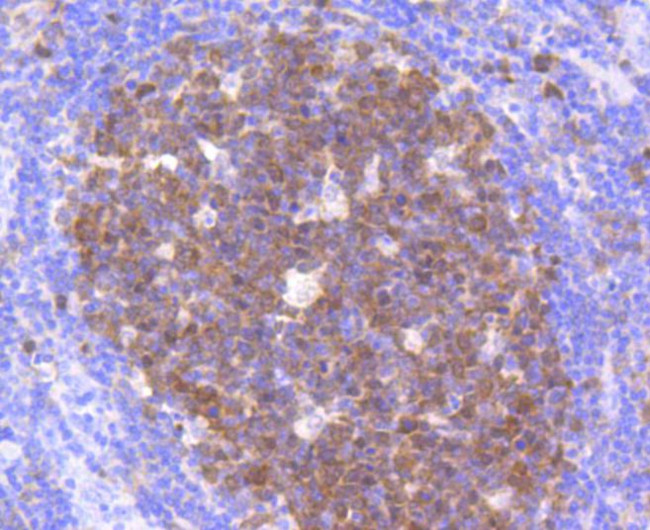 CDK2 Antibody in Immunohistochemistry (Paraffin) (IHC (P))